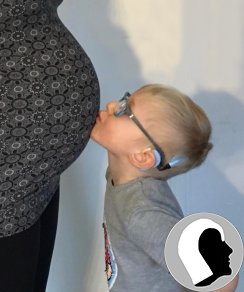 CI Kopf 2018 männlich Kind